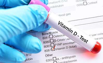 New Method proves Benefit of Vitamin D3 for Cardiovascular Disease 