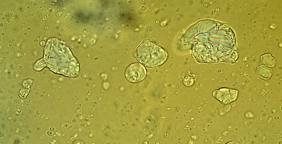 US001 Microscope image